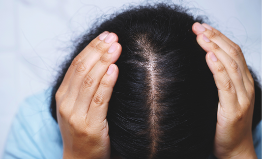 A woman facing hairfall and stunted hair growth